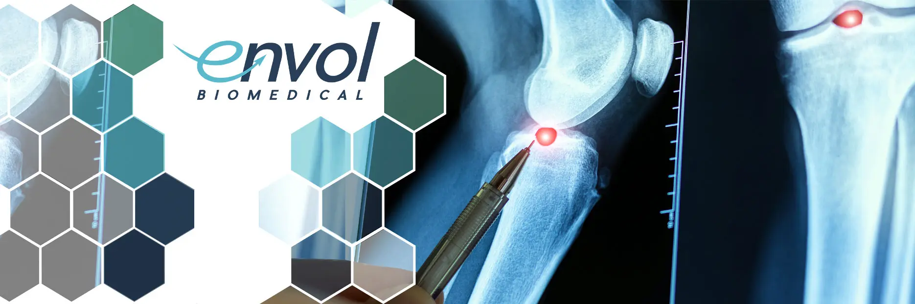 Featured image for “Advancing Musculoskeletal Research: Envol Biomedical Publishes Successful Synovial Fluid Aspiration & Injection Study”