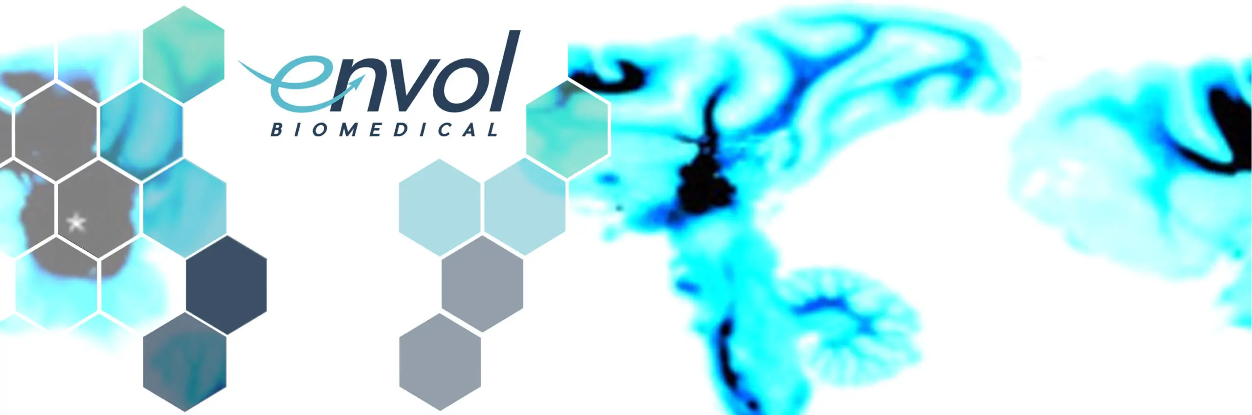 Featured image for “Advancing Neuroscience: Envol & Collaborators Publish Paper on MRI-Guided Thalamic Infusion with Cryo-Fluorescence Tomography”
